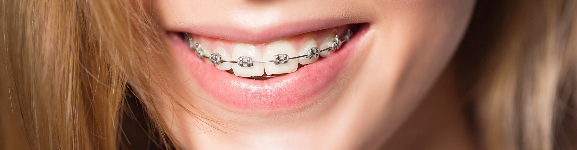 Smiling girl wearing dental braces.